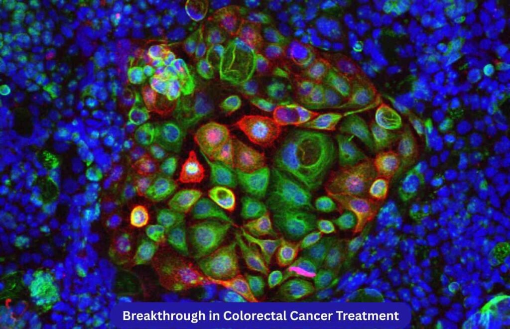 Endoscopic Treatment Colorectal Cancer