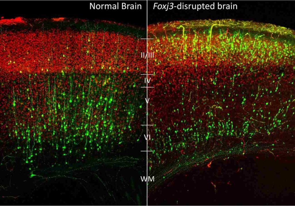FOXJ3 Gene: Connecting Brain Development and Epilepsy FOXJ3 Gene