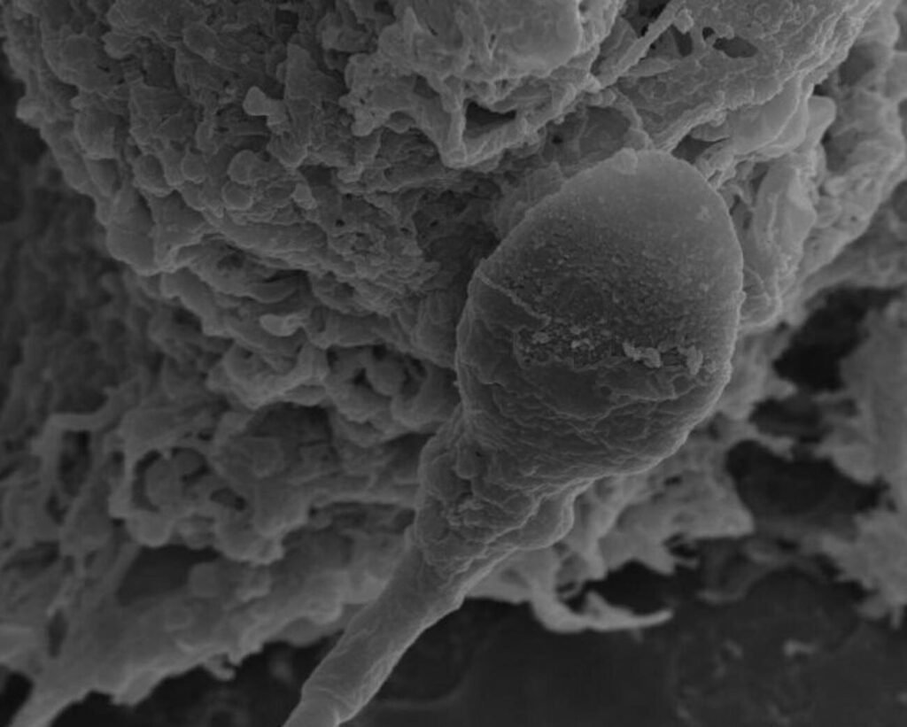 Sperm in Space Lose Ability to Navigate and Find Their Way to the Egg, Study by Australian Researchers Finds Sperm in Space
